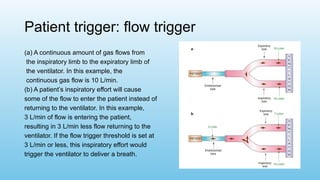 Patient trigger: flow trigger
(a) A continuous amount of gas flows from
the inspiratory limb to the expiratory limb of
the ventilator. In this example, the
continuous gas flow is 10 L/min.
(b) A patient’s inspiratory effort will cause
some of the flow to enter the patient instead of
returning to the ventilator. In this example,
3 L/min of flow is entering the patient,
resulting in 3 L/min less flow returning to the
ventilator. If the flow trigger threshold is set at
3 L/min or less, this inspiratory effort would
trigger the ventilator to deliver a breath.
 