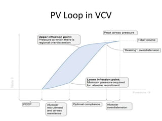 PV Loop in VCV
 