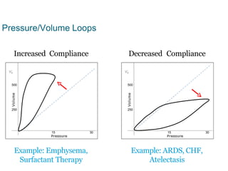 15 30
250
500
15 30
Pressure/Volume Loops
Increased Compliance Decreased Compliance
Example: Emphysema,
Surfactant Therapy
Example: ARDS, CHF,
Atelectasis
500
250
 