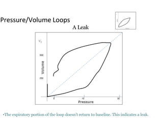 15 305
Pressure/Volume Loops
A Leak
•The expiratory portion of the loop doesn’t return to baseline. This indicates a leak.
500
250
 