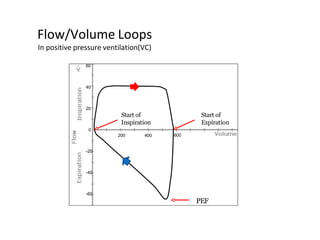 Flow/Volume Loops
In positive pressure ventilation(VC)
0
600
20
40
60
-20
-40
-60
PEF
Start of
Inspiration
200 400
Start of
Expiration
 