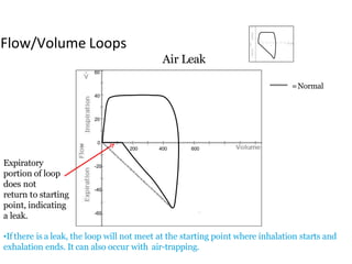 Flow/Volume Loops
0
200 400 600
20
40
60
-20
-40
-60
Expiratory
portion of loop
does not
return to starting
point, indicating
a leak.
Air Leak
•If there is a leak, the loop will not meet at the starting point where inhalation starts and
exhalation ends. It can also occur with air-trapping.
=Normal
 