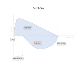 Air Leak
 