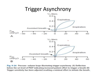 Trigger Asynchrony
 