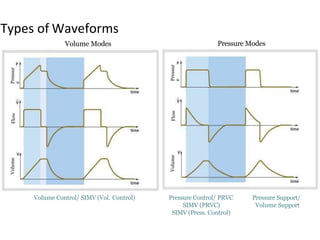 Types of Waveforms
Volume Modes Pressure Modes
Volume Control/ SIMV (Vol. Control) Pressure Control/ PRVC
SIMV (PRVC)
SIMV (Press. Control)
Pressure Support/
Volume Support
Pressur
e
FlowVolume
Pressur
e
FlowVolume
 