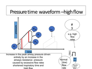 time
pressure
Ppe
ak
Pr
es
Ppl
at
Pr
es
#
3
Increase in the peak airway pressure driven
entirely by an increase in the
airways resistance pressure
caused by excessive flow rates
shortened inspiratory time and
high flow
e.g. high
flow
rates
tim
e
flow
‘Square
wave’
Nor
mal
Normal
(low)
flow
rate
Pressuretime waveform–highflow
 