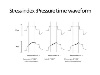 Stressindex:Pressuretime waveform
 