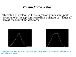 Volume/Time Scalar
The Volume waveform will generally have a “mountain peak”
appearance at the top. It may also have a plateau, or “flattened”
area at the peak of the waveform.
•There will also be a plateau if an inspiratory pause set or inspiratory hold maneuver is
applied to the breath.
 