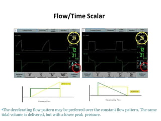 Flow/Time Scalar
•The decelerating flow pattern may be preferred over the constant flow pattern. The same
tidal volume is delivered, but with a lower peak pressure.
 