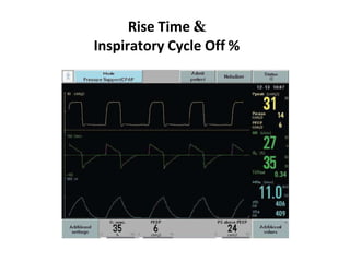 Rise Time &
Inspiratory Cycle Off %
 