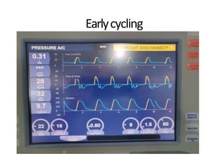 Earlycycling
 
