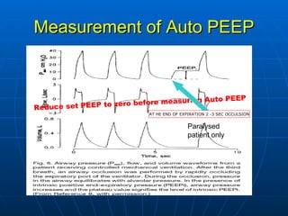 Measurement of Auto PEEP Reduce set PEEP to zero before measuring Auto PEEP Paralysed patient only AT HE END OF EXPIRATION 2 -3 SEC OCCULSION 