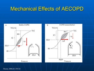 Mechanical Effects of AECOPD Thorax 2006;61:354-61 