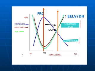 FRC EELV/DH COPD compliance Resistance PVR 