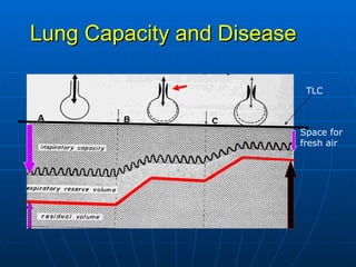 Lung Capacity and Disease Space for fresh air TLC 