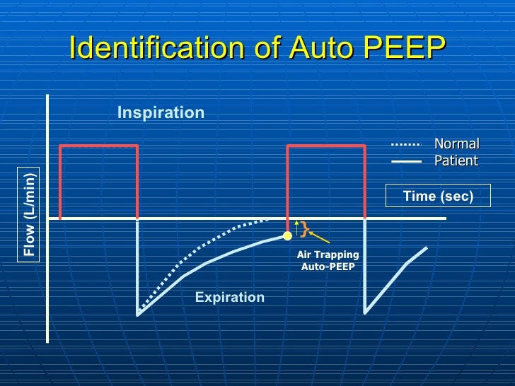 Mechanical ventilation in COPD Asthma drtrc