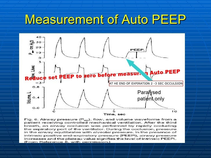 Mechanical ventilation in COPD Asthma drtrc