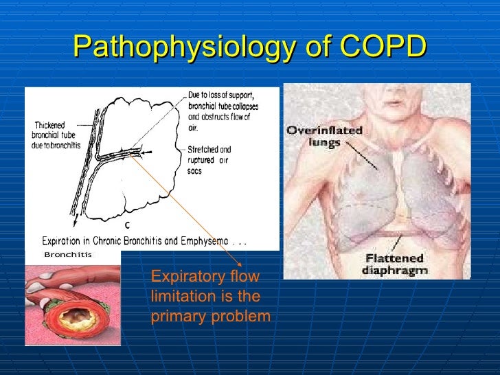 Mechanical ventilation in COPD Asthma drtrc