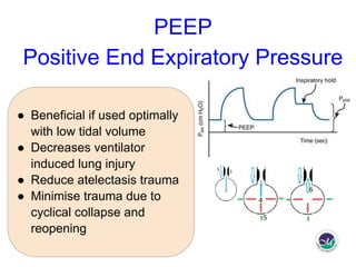 Peep Explained How to initiate mechanical ventilation in Emergency room? | PDF