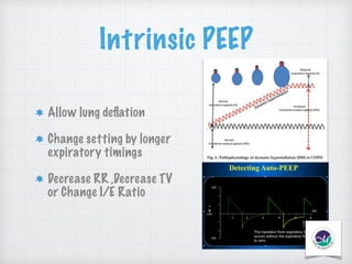 Peep Explained Mechanical ventilation in emergency department | PDF