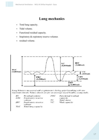17
Mechanical Ventilation - NICU Al Shifaa Hospital - Gaza
Inspiratory & Expiratory Time
Mean Airway Pressure
 