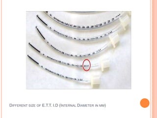 DIFFERENT SIZE OF E.T.T. I.D (INTERNAL DIAMETER IN MM)
 
