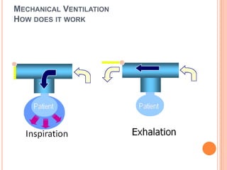 MECHANICAL VENTILATION
HOW DOES IT WORK
 