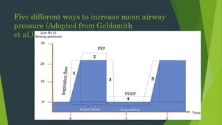 Five different ways to increase mean airway
pressure (Adopted from Goldsmith
et al.).
 