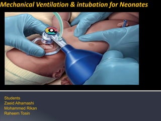 Mechanical Ventilation & intubation for Neonates
Students
Zaeid Alhamashi
Mohammed Rikan
Raheem Tosin
 