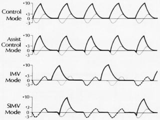 Vent Mode Algorithm Comprehensive Overview of Mechanical Ventilation Principles and Modes ...