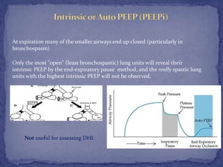 Peep Explained Mechanical ventilation of bronchial asthma, is it a real dilemma | PPTX