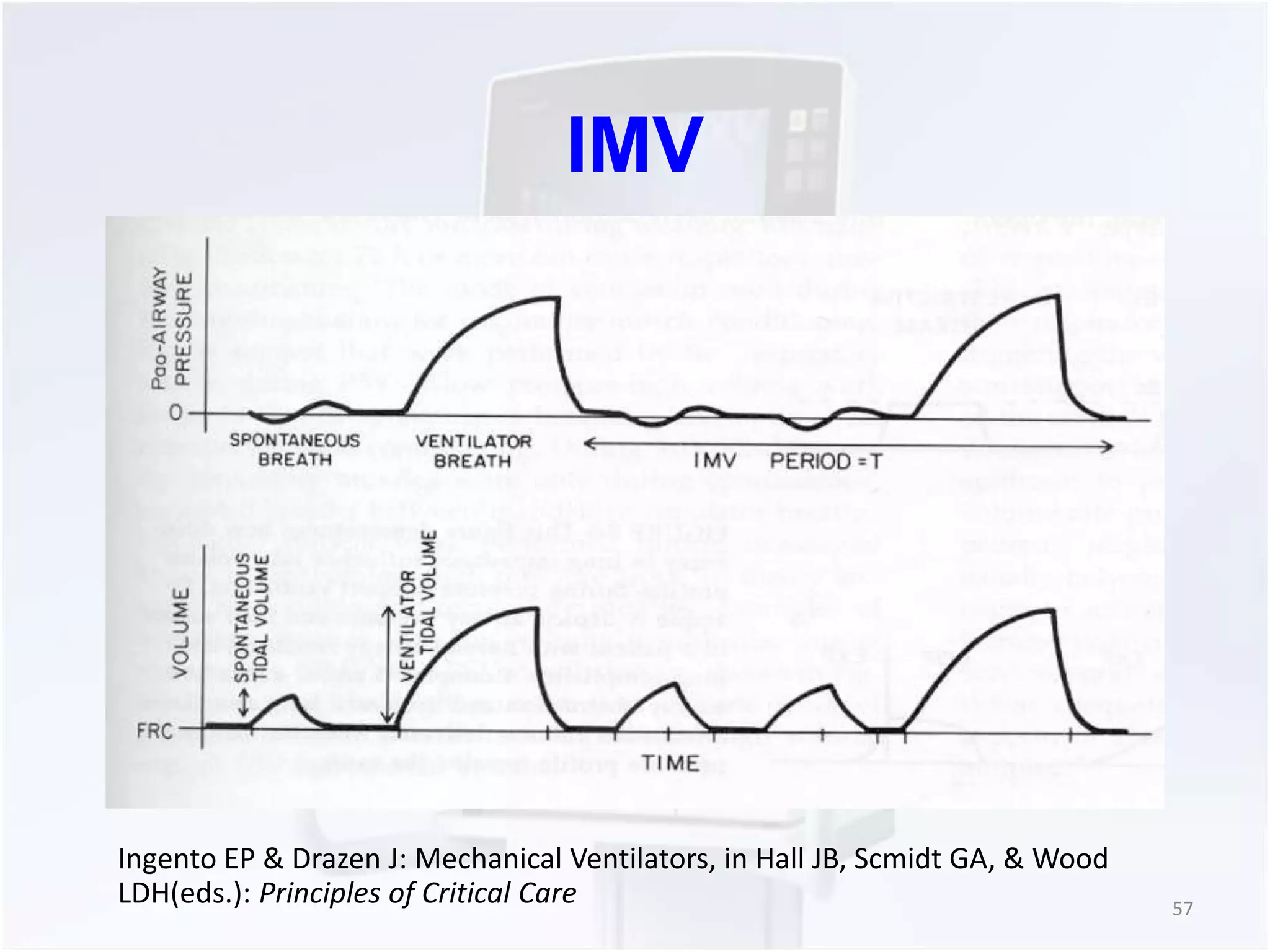 IMV 
57 
Ingento EP & Drazen J: Mechanical Ventilators, in Hall JB, Scmidt GA, & Wood 
LDH(eds.): Principles of Critical Care 
 