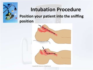 Intubation Procedure 
Position your patient into the sniffing 
position 
 
