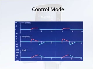 Control Mode 
 