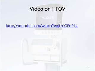 Video on HFOV 
http://youtube.com/watch?v=jLroOPoPlig 
83 
 