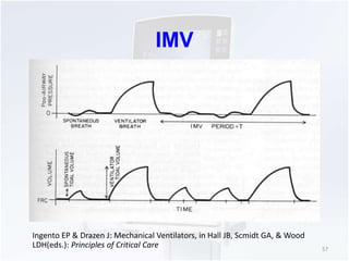 IMV 
57 
Ingento EP & Drazen J: Mechanical Ventilators, in Hall JB, Scmidt GA, & Wood 
LDH(eds.): Principles of Critical C...