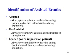 IdentificationofAssistedBreaths•Assisted–Airwaypressurerisesabovebaselineduringinspiration(orfallsbelowbaselineduringexpiration).•Un-Assisted–Airwaypressurestaysconstantduringinspirationorexpiration.•Loaded(workimposedonpatient)–Airwaypressurefallsbelowbaselineduringinspirationandrisesabovebaselineduringexpiration.15