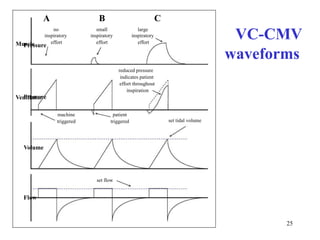ABCPressuresmallinspiratoryeffortlargeinspiratoryeffortnoinspiratoryeffortVC-CMVMusclewaveformsreducedpressureindicatespatienteffortthroughoutinspirationVentilatorPressurepatientmachinesettidalvolumetriggeredtriggeredVolumesetflow25Flow