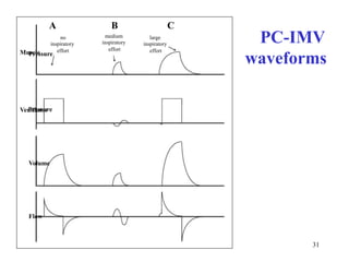 ACBPC-IMVwaveformsmediuminspiratoryeffortPressurelargeinspiratoryeffortnoinspiratoryeffortMuscleVentilatorPressureVolumeFlow31