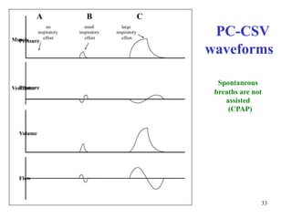 ABCPressuresmallinspiratoryeffortlargeinspiratoryeffortnoinspiratoryeffortPC-CSVMusclewaveformsSpontaneousbreathsarenotassisted(CPAP)33VentilatorPressureVolumeFlow