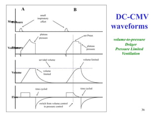 ABPressureDC-CMVwaveformsvolume-to-pressuresmallinspiratoryeffortplateaupressureMusclesetPmaxVentilatorPressureDrägerPressureLimitedVentilationplateaupressurevolumelimitedtimecycledsettidalvolumevolumelimitedtimecycledVolumeFlowswitchfromvolumecontroltopressurecontrol36