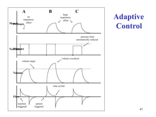 AnoinspiratoryeffortBCAdaptiveControllargeinspiratoryeffortPressureMusclepressurelimitautomaticallyreducedvolumeovershootvolumetargettimecycledVentilatorPressureVolumeFlowpatienttriggeredmachinetriggered47