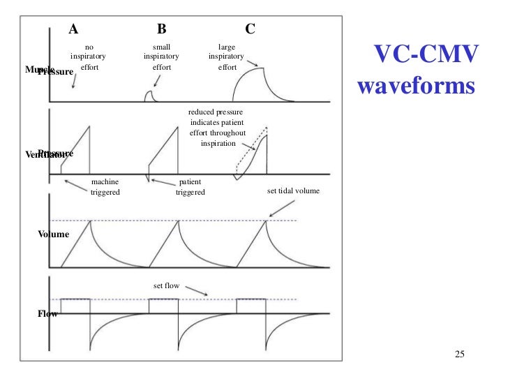 Mechanical ventilation, understanding modes.
