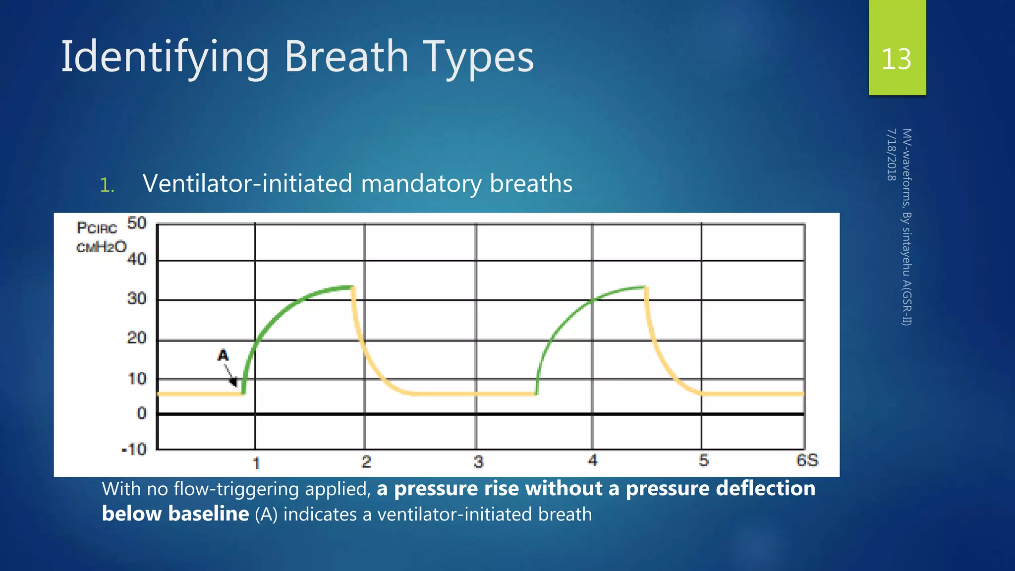 Identifying Breath Types
1. Ventilator-initiated mandatory breaths
13
With no flow-triggering applied, a pressure rise without a pressure deflection
below baseline (A) indicates a ventilator-initiated breath
 