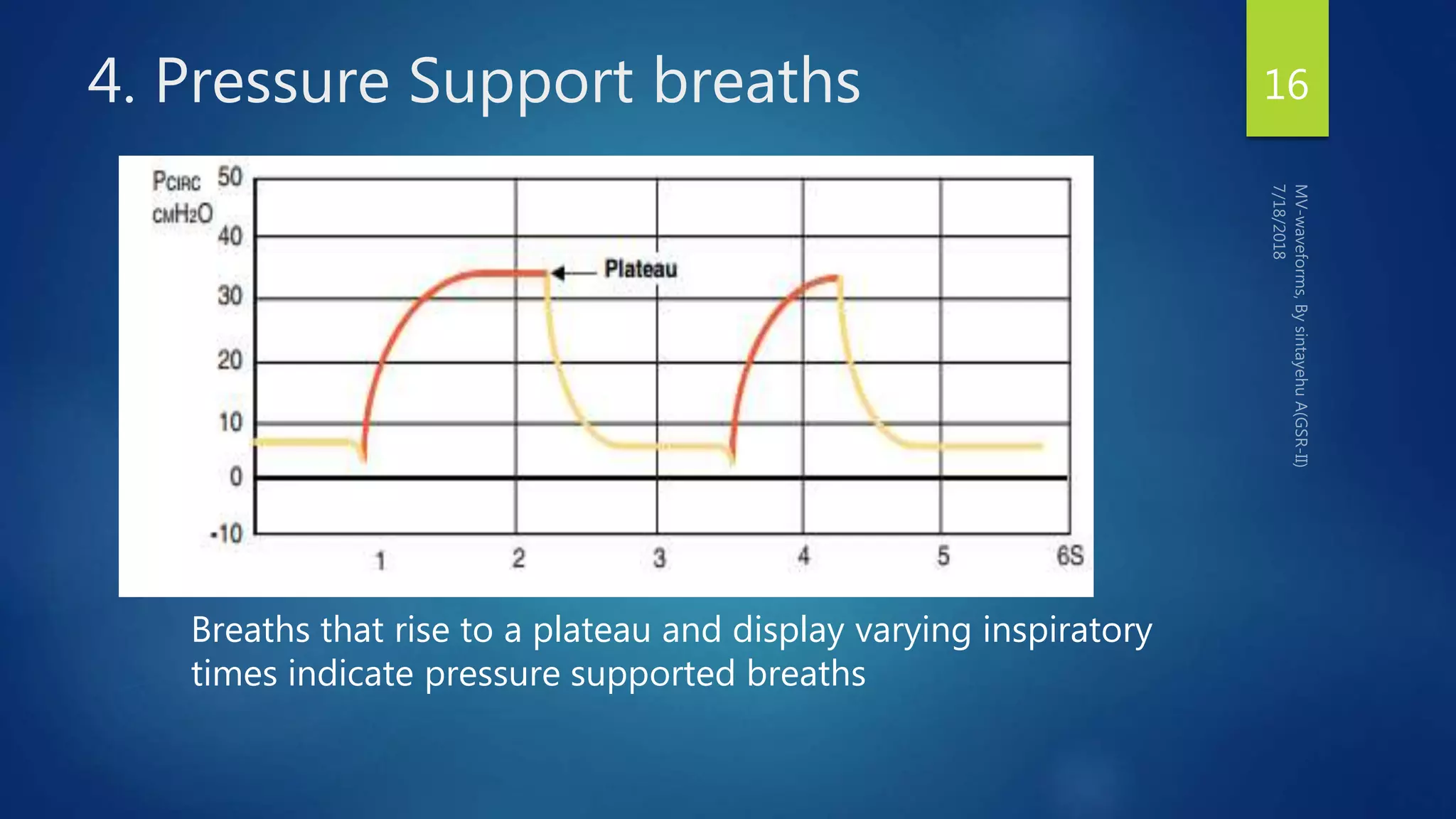4. Pressure Support breaths 16
Breaths that rise to a plateau and display varying inspiratory
times indicate pressure supported breaths
 