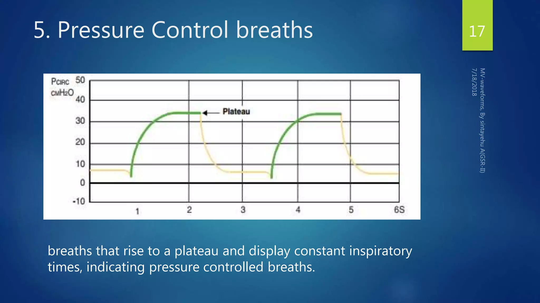 5. Pressure Control breaths 17
breaths that rise to a plateau and display constant inspiratory
times, indicating pressure controlled breaths.
 