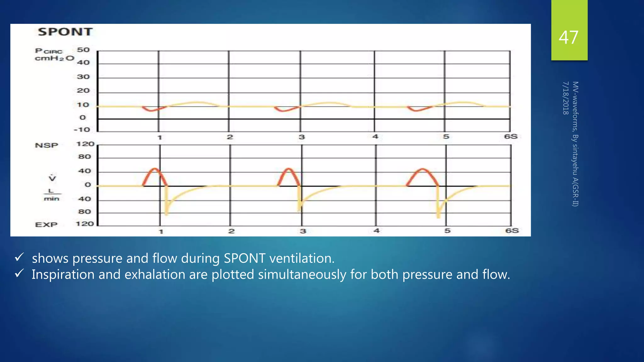 47
 shows pressure and flow during SPONT ventilation.
 Inspiration and exhalation are plotted simultaneously for both pressure and flow.
 