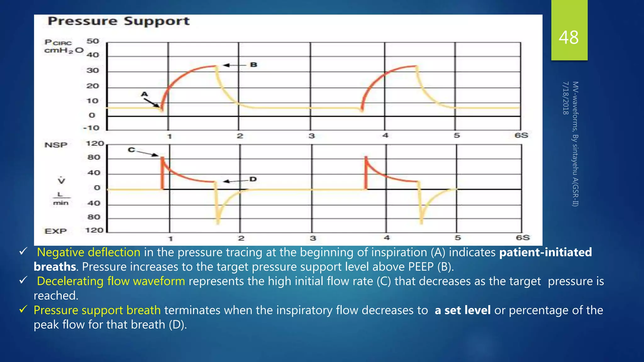 48
 Negative deflection in the pressure tracing at the beginning of inspiration (A) indicates patient-initiated
breaths. Pressure increases to the target pressure support level above PEEP (B).
 Decelerating flow waveform represents the high initial flow rate (C) that decreases as the target pressure is
reached.
 Pressure support breath terminates when the inspiratory flow decreases to a set level or percentage of the
peak flow for that breath (D).
 