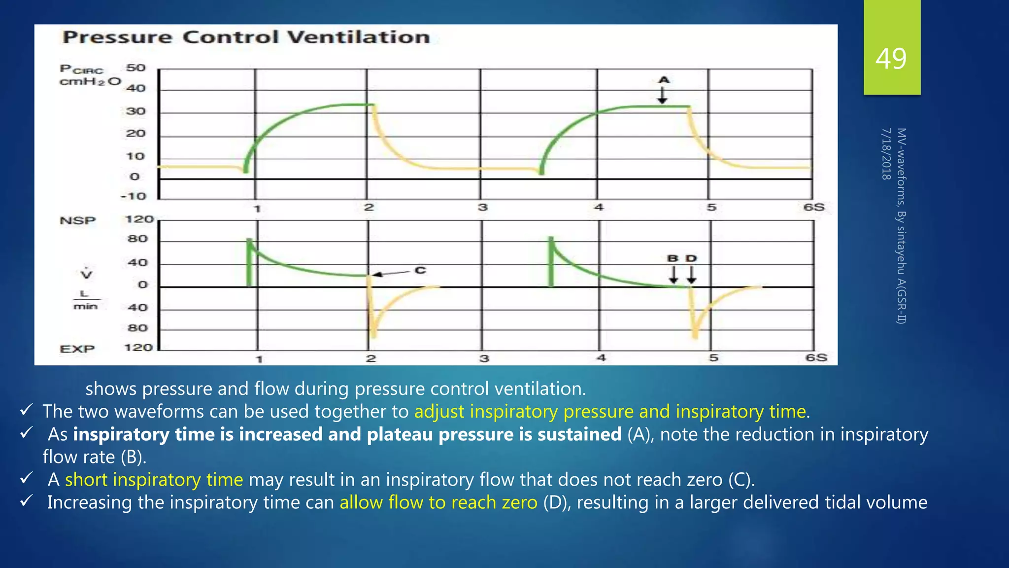 49
shows pressure and flow during pressure control ventilation.
 The two waveforms can be used together to adjust inspiratory pressure and inspiratory time.
 As inspiratory time is increased and plateau pressure is sustained (A), note the reduction in inspiratory
flow rate (B).
 A short inspiratory time may result in an inspiratory flow that does not reach zero (C).
 Increasing the inspiratory time can allow flow to reach zero (D), resulting in a larger delivered tidal volume
 