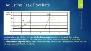 Vent Rise Stability Chart Mechanical ventilation wave forms | PPTX
